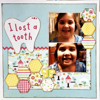 I Lost A Tooth